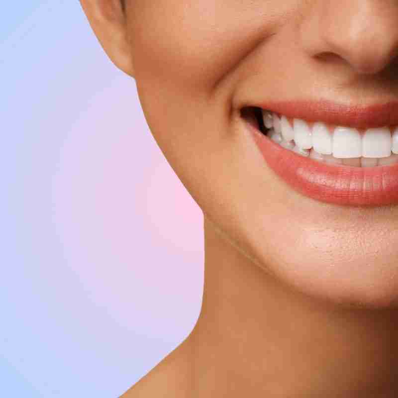 Close-up of a smiling woman showcasing a radiant, white smile against a soft gradient background, representing cosmetic dentistry and smile transformations at JAX Dental Arts in St. Augustine.