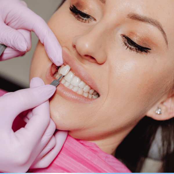 Woman receiving dental shade matching for cosmetic dentistry, showcasing dental implants and aesthetic restoration.