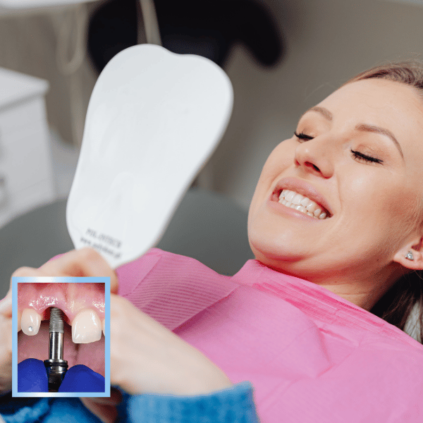 Woman smiling in dental chair during dental implant procedure, showcasing dental implant in mouth and mirror reflection, emphasizing comfort and restoration of natural smile.