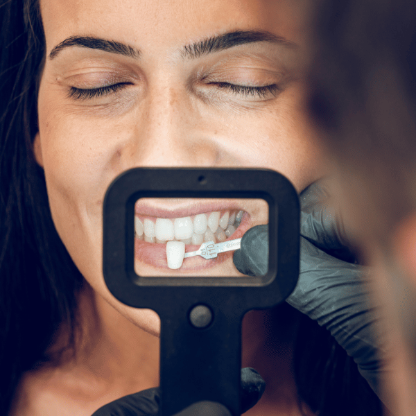 Woman with closed eyes smiling while a dental professional holds a shade guide near her teeth, assessing color for porcelain veneers at JAX Dental Arts.